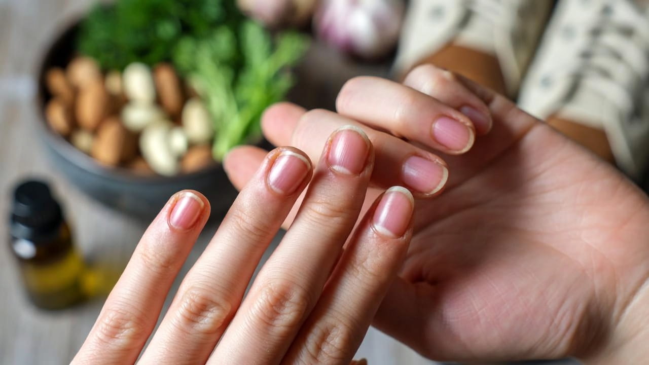 Bring Back Natural Nail Color